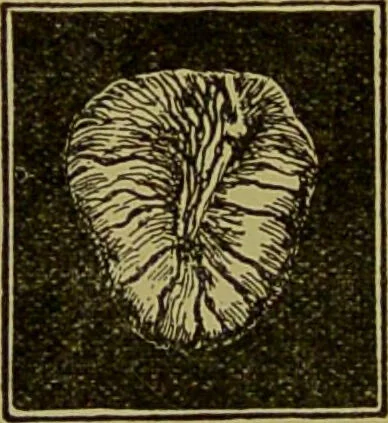An illustration from Diseases of the ear, nose, and throat and their accessory cavities : A condensed text-book / By Seth Scott Bishop., 1897, leaf 94