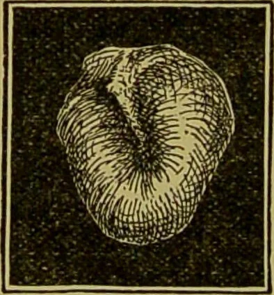 An illustration from Diseases of the ear, nose, and throat and their accessory cavities : A condensed text-book / By Seth Scott Bishop., 1897, leaf 98
