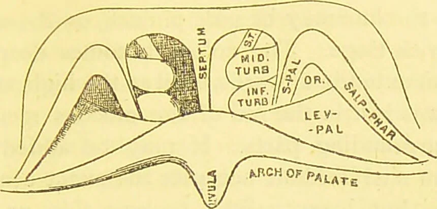An illustration from Laryngoscopy and rhinoscopy and the diagnosis and treatment of the diseases of the throat and nose / by Prosser James, M.D., 1888, leaf 111