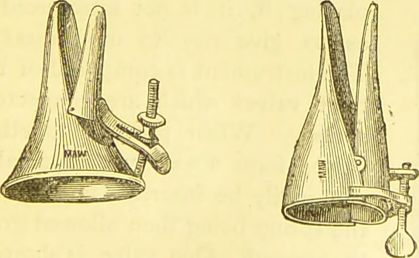 An illustration from Laryngoscopy and rhinoscopy and the diagnosis and treatment of the diseases of the throat and nose / by Prosser James, M.D., 1888, leaf 121
