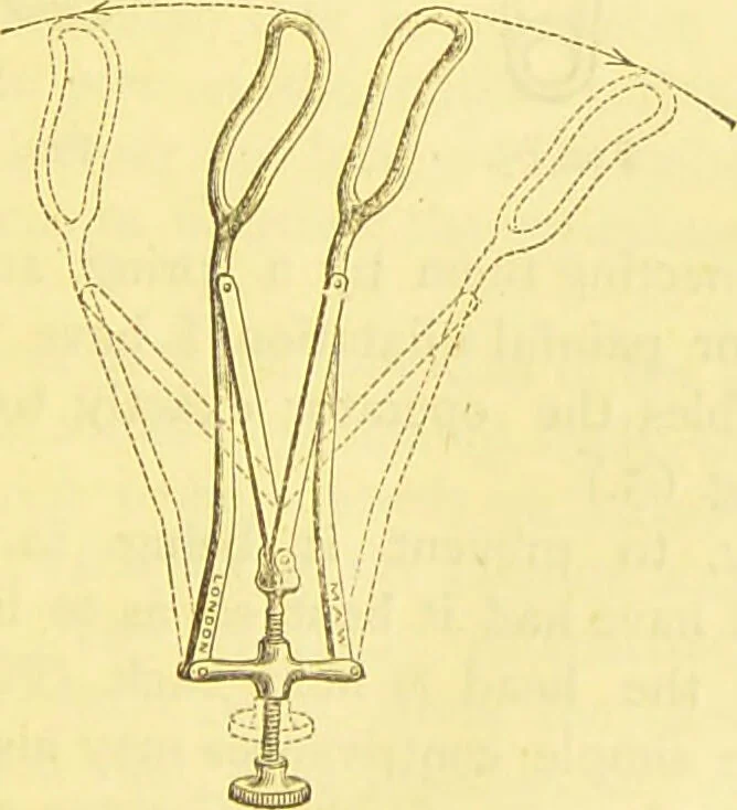 An illustration from Laryngoscopy and rhinoscopy and the diagnosis and treatment of the diseases of the throat and nose / by Prosser James, M.D., 1888, leaf 123