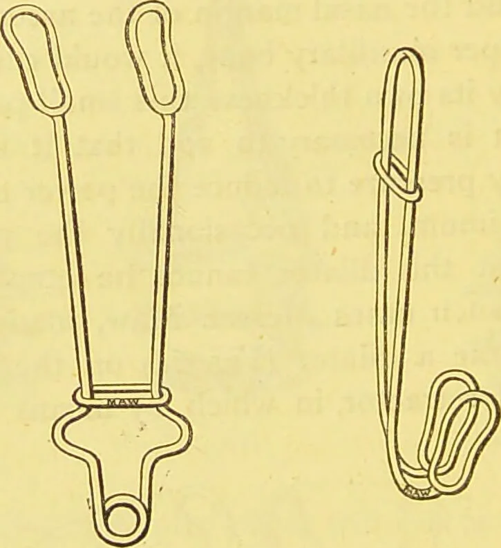 An illustration from Laryngoscopy and rhinoscopy and the diagnosis and treatment of the diseases of the throat and nose / by Prosser James, M.D., 1888, leaf 124