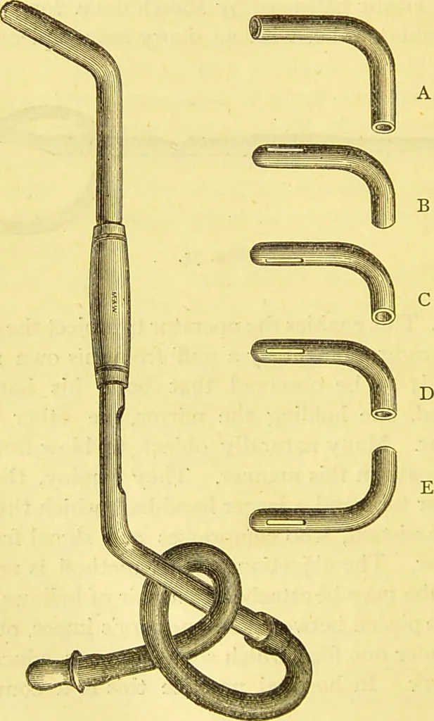 An illustration from Laryngoscopy and rhinoscopy and the diagnosis and treatment of the diseases of the throat and nose / by Prosser James, M.D., 1888, leaf 202