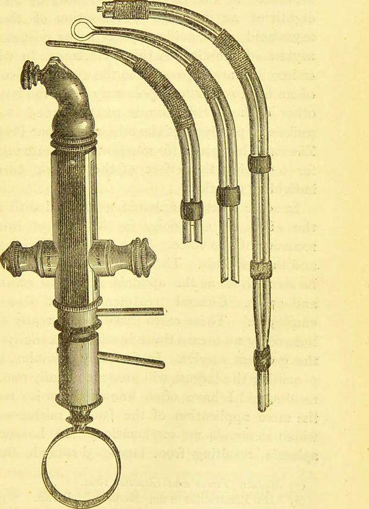 An illustration from Laryngoscopy and rhinoscopy and the diagnosis and treatment of the diseases of the throat and nose / by Prosser James, M.D., 1888, leaf 215