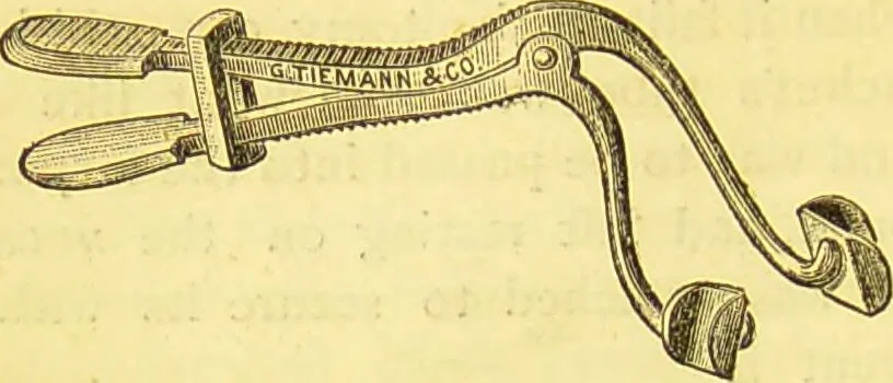An illustration from Laryngoscopy and rhinoscopy and the diagnosis and treatment of the diseases of the throat and nose / by Prosser James, M.D., 1888, leaf 220