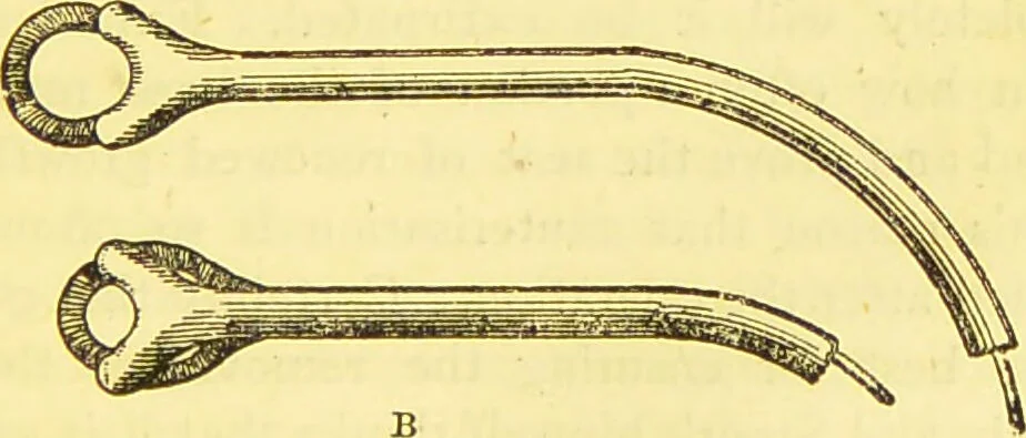 An illustration from Laryngoscopy and rhinoscopy and the diagnosis and treatment of the diseases of the throat and nose / by Prosser James, M.D., 1888, leaf 227