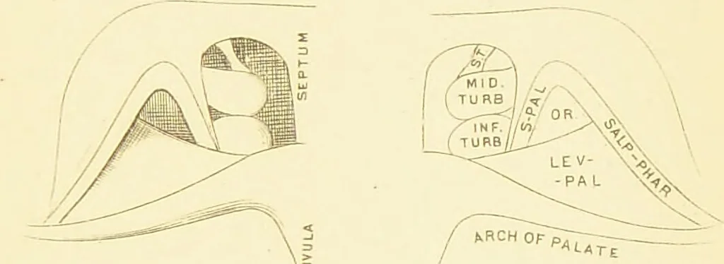 An illustration from Laryngoscopy and rhinoscopy and the diagnosis and treatment of the diseases of the throat and nose / by Prosser James, M.D., 1888, leaf 23