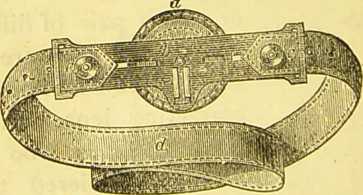 An illustration from Laryngoscopy and rhinoscopy and the diagnosis and treatment of the diseases of the throat and nose / by Prosser James, M.D., 1888, leaf 32
