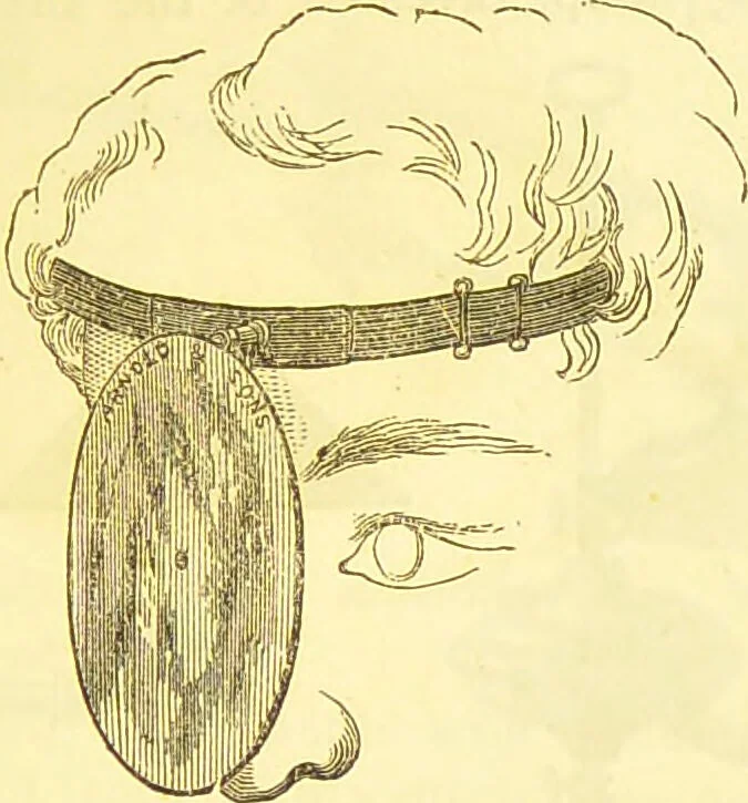 An illustration from Laryngoscopy and rhinoscopy and the diagnosis and treatment of the diseases of the throat and nose / by Prosser James, M.D., 1888, leaf 33