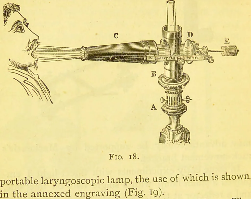 An illustration from Laryngoscopy and rhinoscopy and the diagnosis and treatment of the diseases of the throat and nose / by Prosser James, M.D., 1888, leaf 36