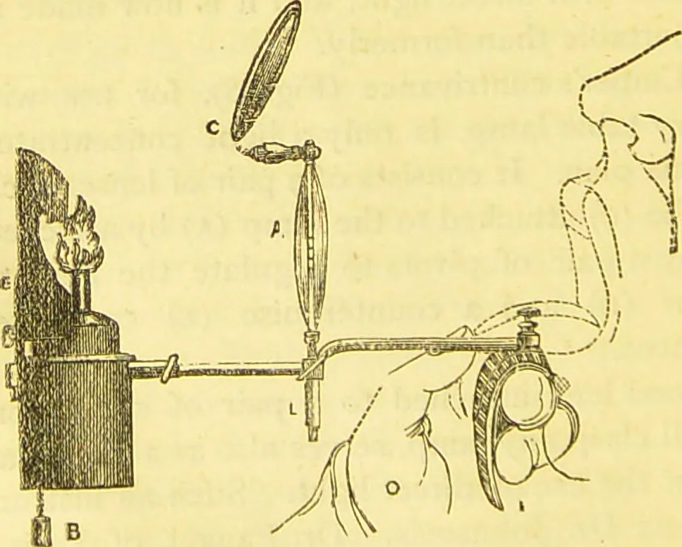 An illustration from Laryngoscopy and rhinoscopy and the diagnosis and treatment of the diseases of the throat and nose / by Prosser James, M.D., 1888, leaf 36