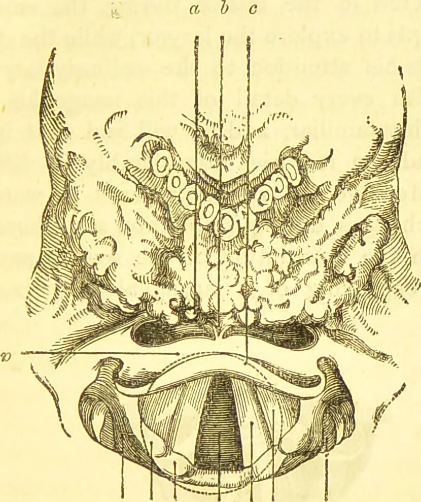 An illustration from Laryngoscopy and rhinoscopy and the diagnosis and treatment of the diseases of the throat and nose / by Prosser James, M.D., 1888, leaf 49