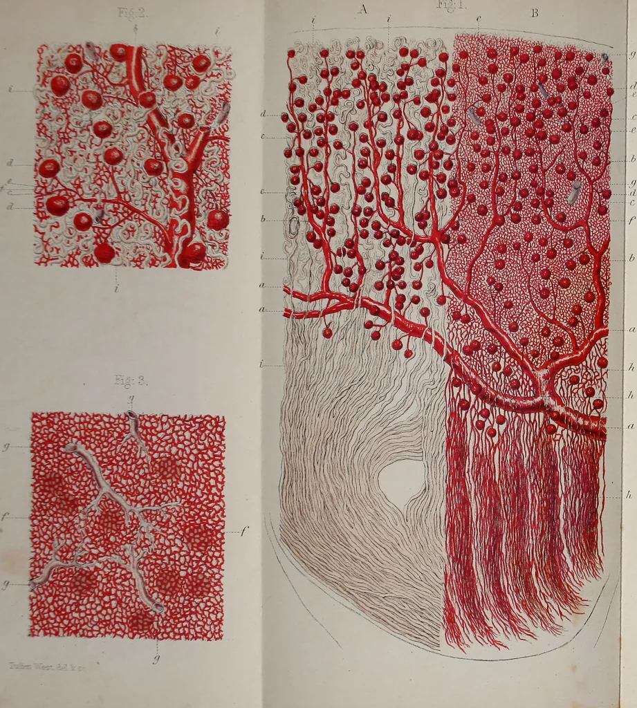 An illustration from Lectures on the diseases of the kidney, generally known as "Brights' disease", and dropsy / by S. J. Goodfellow., 1861, leaf 8