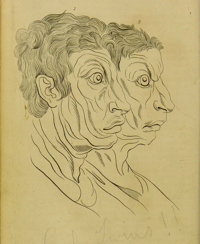 An illustration from Essays on physiognomy : designed to promote the knowledge and the love of mankind / written in the German language by John Caspar Lavater ; and translated into English by Thomas Holcroft ; to which are added, One hundred physiognomonical rules, a posthumous work by Mr. Lavater ; and memoirs of the life of the author, compiled principally from the life of Lavater, by G. Gessner., 1848, leaf 404