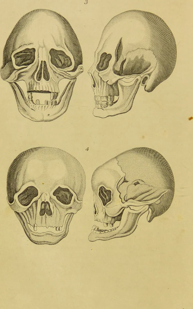 An illustration from Essays on physiognomy : designed to promote the knowledge and the love of mankind / written in the German language by John Caspar Lavater ; and translated into English by Thomas Holcroft ; to which are added, One hundred physiognomonical rules, a posthumous work by Mr. Lavater ; and memoirs of the life of the author, compiled principally from the life of Lavater, by G. Gessner., 1848, leaf 462