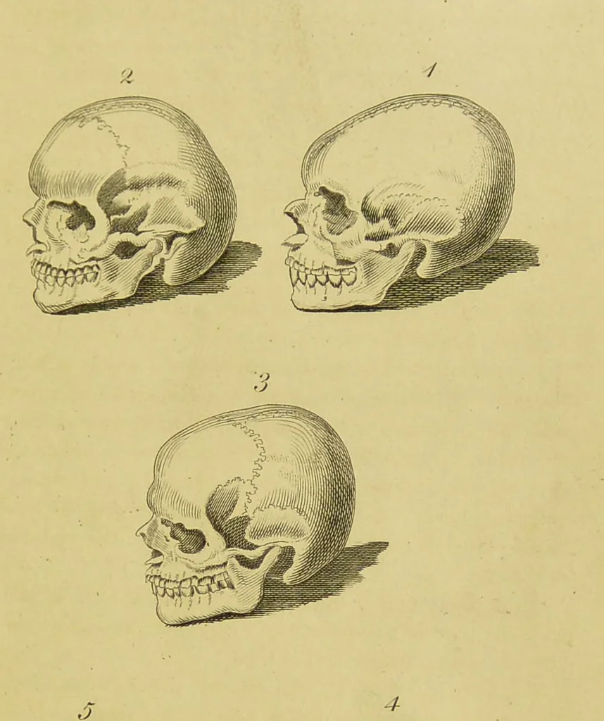 An illustration from Essays on physiognomy : designed to promote the knowledge and the love of mankind / written in the German language by John Caspar Lavater ; and translated into English by Thomas Holcroft ; to which are added, One hundred physiognomonical rules, a posthumous work by Mr. Lavater ; and memoirs of the life of the author, compiled principally from the life of Lavater, by G. Gessner., 1848, leaf 465