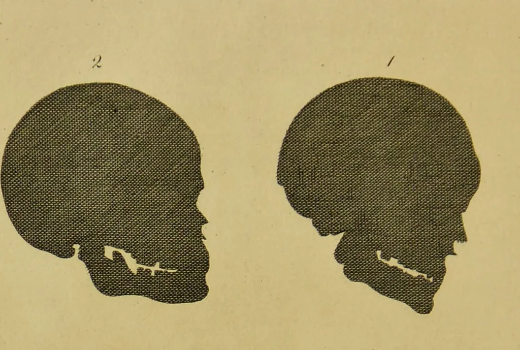 An illustration from Essays on physiognomy : designed to promote the knowledge and the love of mankind / written in the German language by John Caspar Lavater ; and translated into English by Thomas Holcroft ; to which are added, One hundred physiognomonical rules, a posthumous work by Mr. Lavater ; and memoirs of the life of the author, compiled principally from the life of Lavater, by G. Gessner., 1848, leaf 474