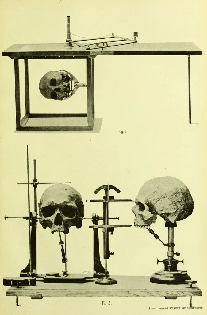 An illustration from Norrønaskaller : crania antiqua in parte orientali Norvegiae meridionalis inventa / en studie fra Universitetets Anatomiske Institut og dette tilegnet af Justus Barth ... ; udgivet ved G.A. Guldberg., 1896, leaf 209