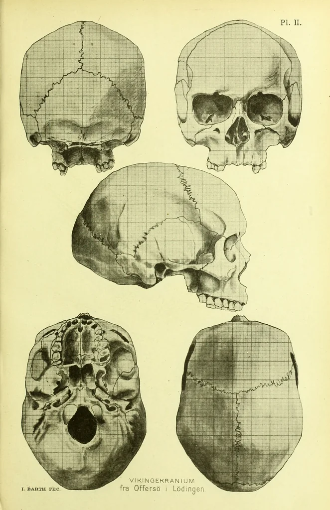 An illustration from Norrønaskaller : crania antiqua in parte orientali Norvegiae meridionalis inventa / en studie fra Universitetets Anatomiske Institut og dette tilegnet af Justus Barth ... ; udgivet ved G.A. Guldberg., 1896, leaf 211