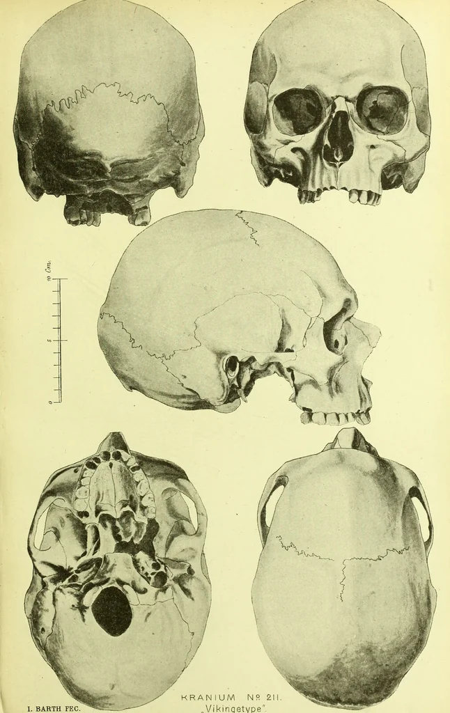 An illustration from Norrønaskaller : crania antiqua in parte orientali Norvegiae meridionalis inventa / en studie fra Universitetets Anatomiske Institut og dette tilegnet af Justus Barth ... ; udgivet ved G.A. Guldberg., 1896, leaf 215
