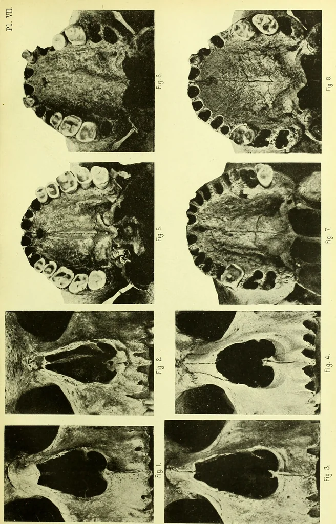 An illustration from Norrønaskaller : crania antiqua in parte orientali Norvegiae meridionalis inventa / en studie fra Universitetets Anatomiske Institut og dette tilegnet af Justus Barth ... ; udgivet ved G.A. Guldberg., 1896, leaf 221