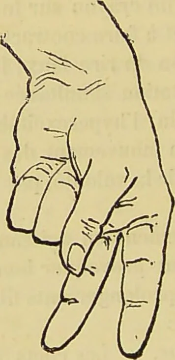An illustration from Le magnétisme animal / par Alfred Binet et Ch. Féré., 1887, leaf 92