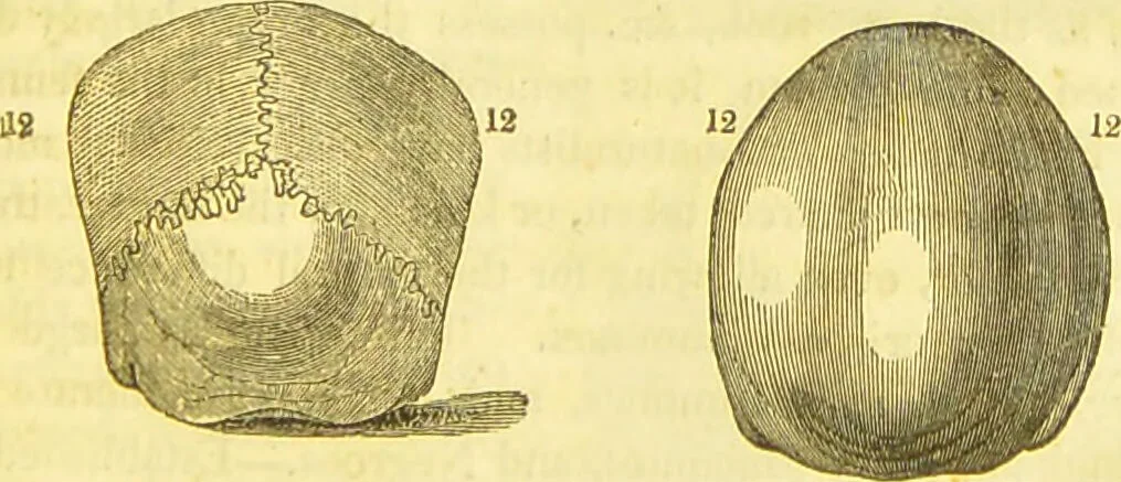 An illustration from Elements of phrenology / by George Combe., 1836, leaf 105