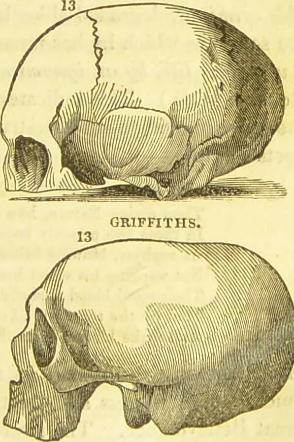 An illustration from Elements of phrenology / by George Combe., 1836, leaf 107