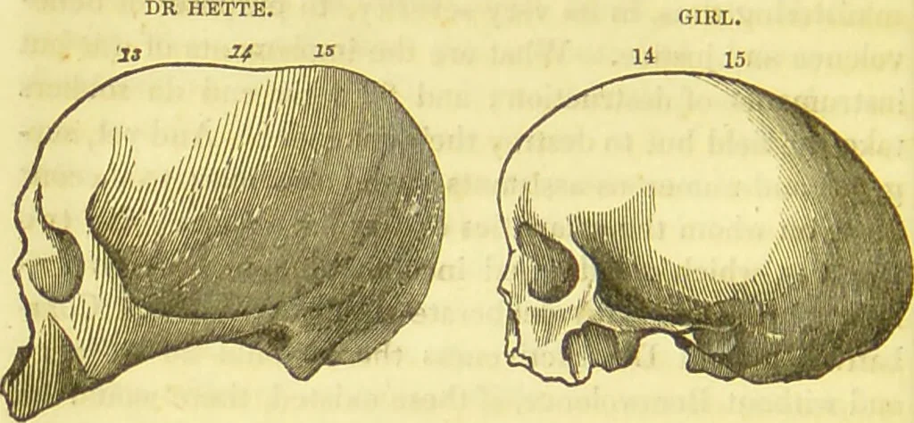 An illustration from Elements of phrenology / by George Combe., 1836, leaf 110