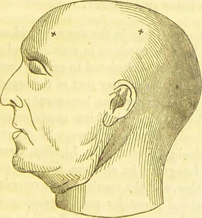 An illustration from Elements of phrenology / by George Combe., 1836, leaf 191