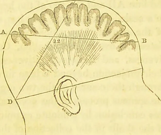 An illustration from Elements of phrenology / by George Combe., 1836, leaf 49