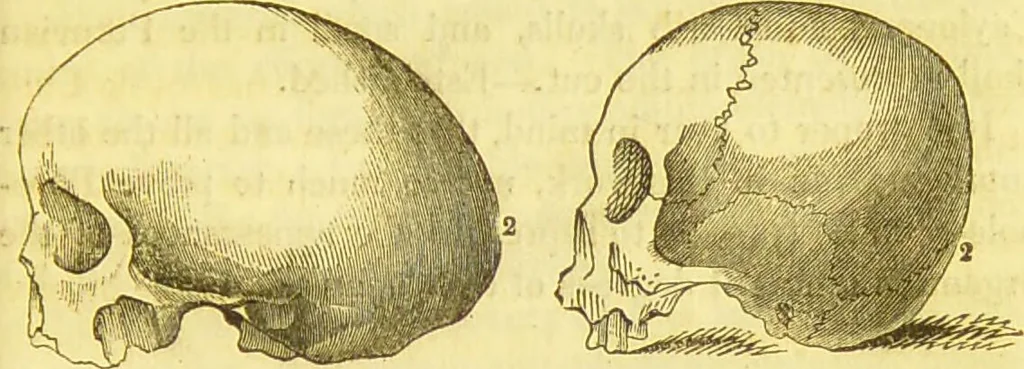 An illustration from Elements of phrenology / by George Combe., 1836, leaf 83