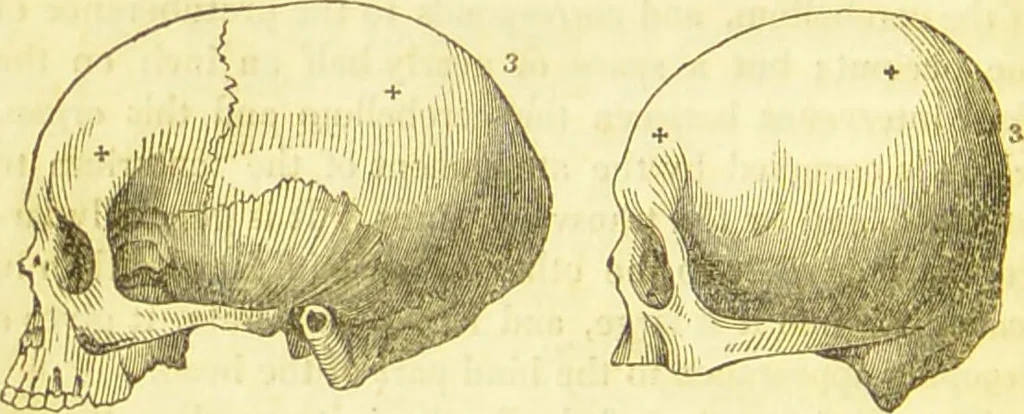 An illustration from Elements of phrenology / by George Combe., 1836, leaf 84