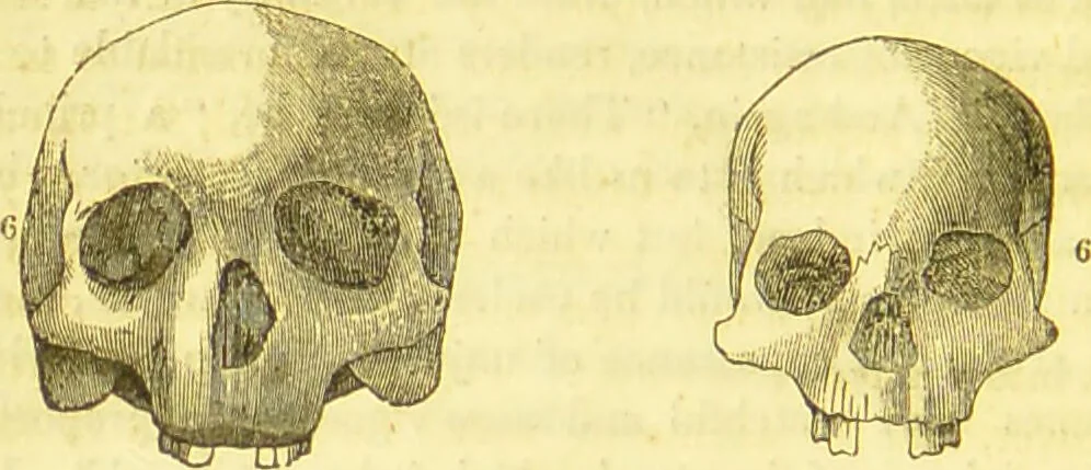 An illustration from Elements of phrenology / by George Combe., 1836, leaf 90