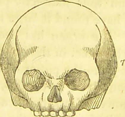 An illustration from Elements of phrenology / by George Combe., 1836, leaf 93
