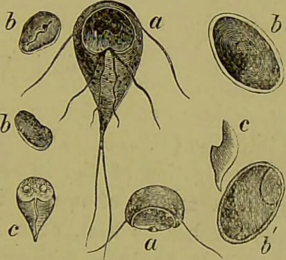 An illustration from Clinical diagnosis : the bacteriological, chemical, and microscopical evidence of disease / By Dr. Rudolf v. Jaksch, ... Translated from the third German edition and enlarged by James Cagney, ... With numerous illustrations (partly in colours)., 1893, leaf 209