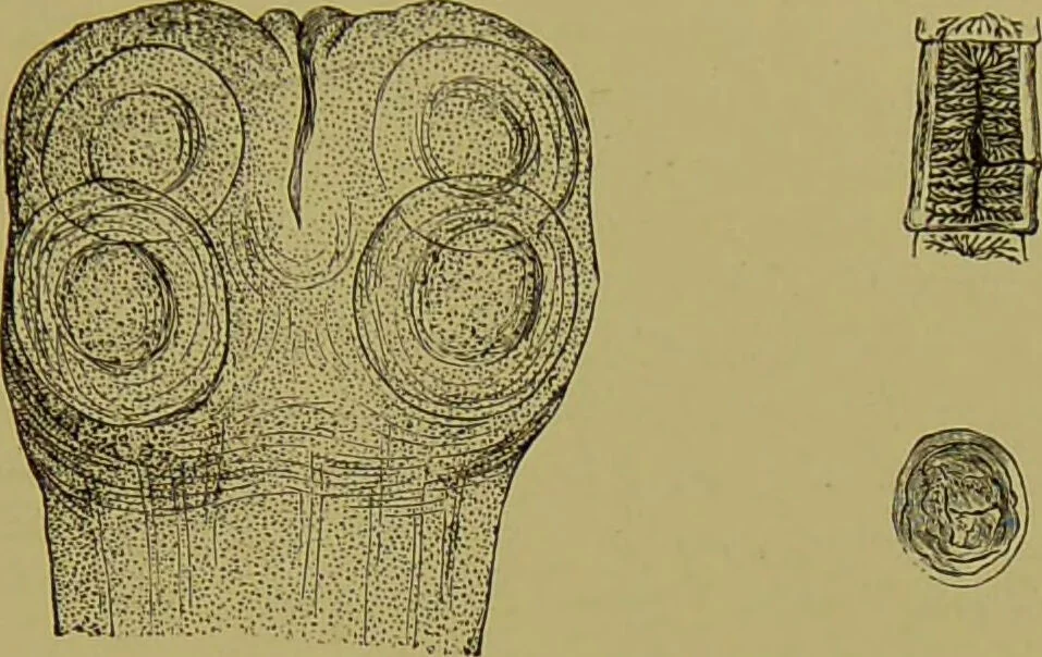 An illustration from Clinical diagnosis : the bacteriological, chemical, and microscopical evidence of disease / By Dr. Rudolf v. Jaksch, ... Translated from the third German edition and enlarged by James Cagney, ... With numerous illustrations (partly in colours)., 1893, leaf 211