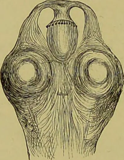 An illustration from Clinical diagnosis : the bacteriological, chemical, and microscopical evidence of disease / By Dr. Rudolf v. Jaksch, ... Translated from the third German edition and enlarged by James Cagney, ... With numerous illustrations (partly in colours)., 1893, leaf 212