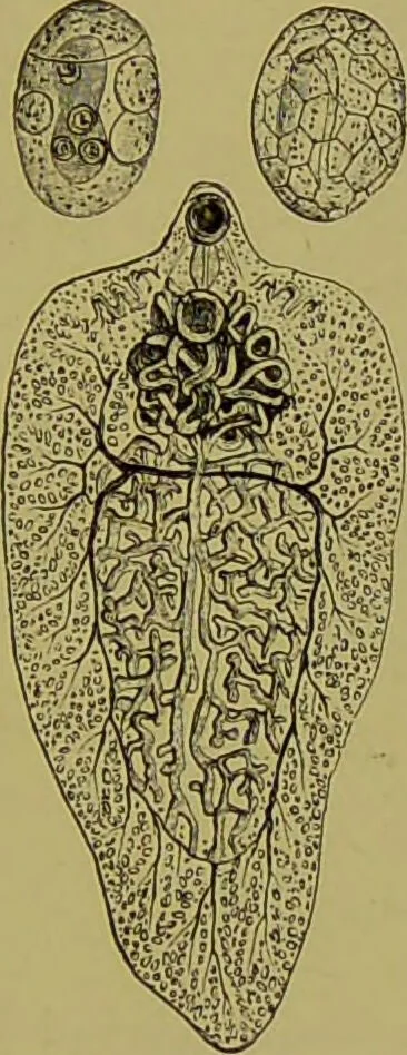 An illustration from Clinical diagnosis : the bacteriological, chemical, and microscopical evidence of disease / By Dr. Rudolf v. Jaksch, ... Translated from the third German edition and enlarged by James Cagney, ... With numerous illustrations (partly in colours)., 1893, leaf 215