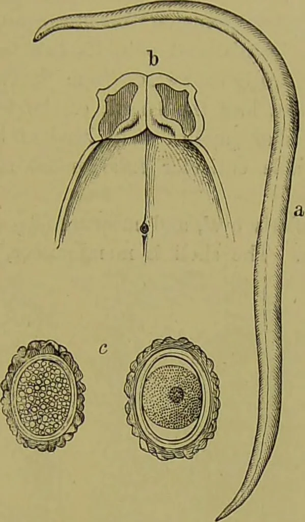 An illustration from Clinical diagnosis : the bacteriological, chemical, and microscopical evidence of disease / By Dr. Rudolf v. Jaksch, ... Translated from the third German edition and enlarged by James Cagney, ... With numerous illustrations (partly in colours)., 1893, leaf 217