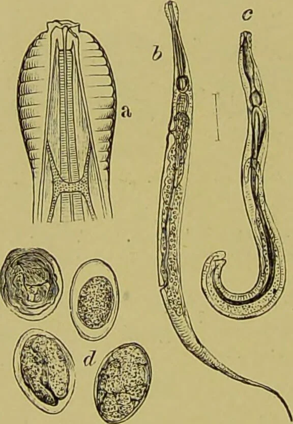 An illustration from Clinical diagnosis : the bacteriological, chemical, and microscopical evidence of disease / By Dr. Rudolf v. Jaksch, ... Translated from the third German edition and enlarged by James Cagney, ... With numerous illustrations (partly in colours)., 1893, leaf 218