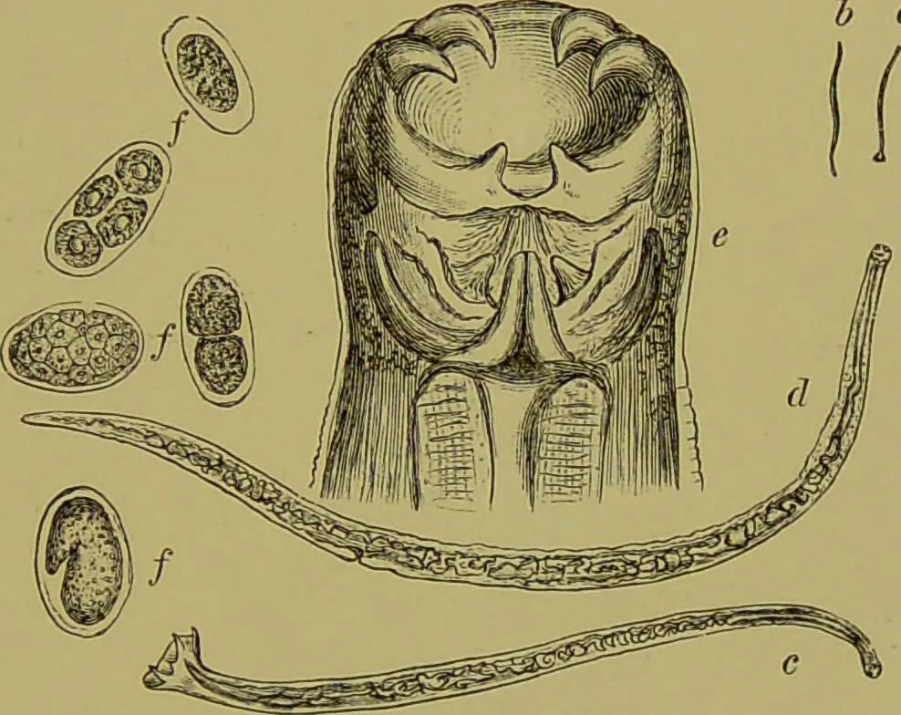 An illustration from Clinical diagnosis : the bacteriological, chemical, and microscopical evidence of disease / By Dr. Rudolf v. Jaksch, ... Translated from the third German edition and enlarged by James Cagney, ... With numerous illustrations (partly in colours)., 1893, leaf 219