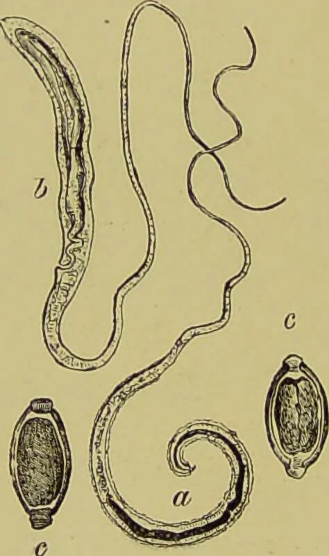 An illustration from Clinical diagnosis : the bacteriological, chemical, and microscopical evidence of disease / By Dr. Rudolf v. Jaksch, ... Translated from the third German edition and enlarged by James Cagney, ... With numerous illustrations (partly in colours)., 1893, leaf 220