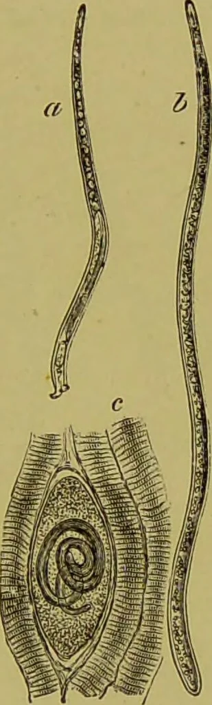 An illustration from Clinical diagnosis : the bacteriological, chemical, and microscopical evidence of disease / By Dr. Rudolf v. Jaksch, ... Translated from the third German edition and enlarged by James Cagney, ... With numerous illustrations (partly in colours)., 1893, leaf 221