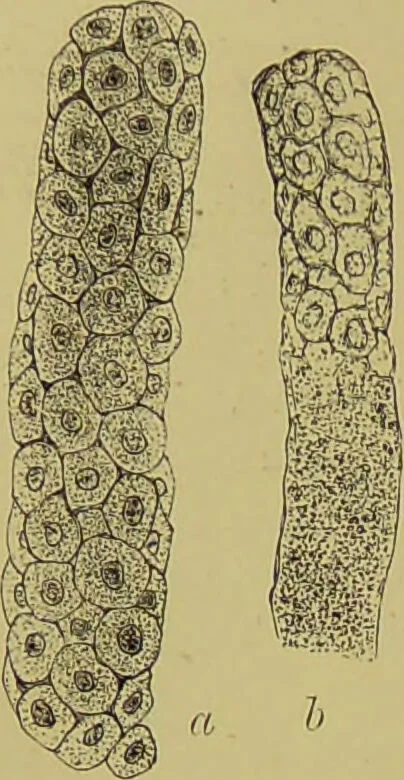 An illustration from Clinical diagnosis : the bacteriological, chemical, and microscopical evidence of disease / By Dr. Rudolf v. Jaksch, ... Translated from the third German edition and enlarged by James Cagney, ... With numerous illustrations (partly in colours)., 1893, leaf 254