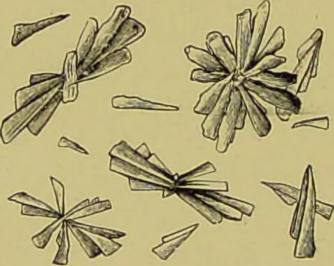 An illustration from Clinical diagnosis : the bacteriological, chemical, and microscopical evidence of disease / By Dr. Rudolf v. Jaksch, ... Translated from the third German edition and enlarged by James Cagney, ... With numerous illustrations (partly in colours)., 1893, leaf 270