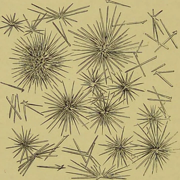 An illustration from Clinical diagnosis : the bacteriological, chemical, and microscopical evidence of disease / By Dr. Rudolf v. Jaksch, ... Translated from the third German edition and enlarged by James Cagney, ... With numerous illustrations (partly in colours)., 1893, leaf 274