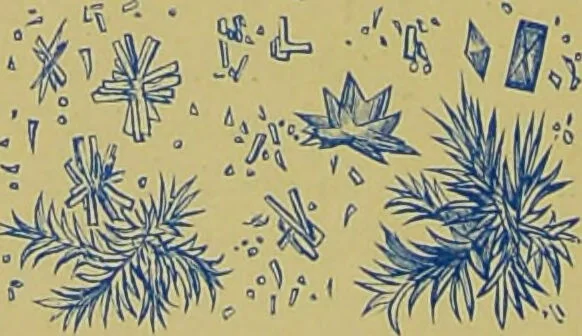 An illustration from Clinical diagnosis : the bacteriological, chemical, and microscopical evidence of disease / By Dr. Rudolf v. Jaksch, ... Translated from the third German edition and enlarged by James Cagney, ... With numerous illustrations (partly in colours)., 1893, leaf 276