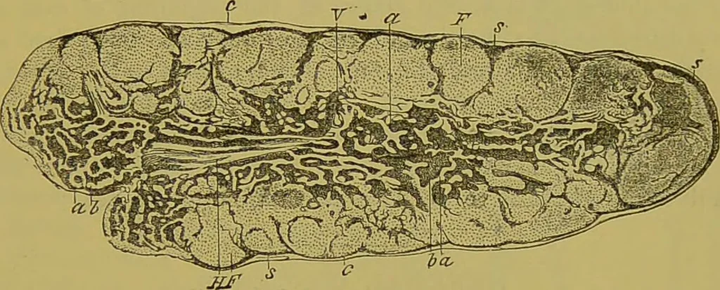 An illustration from Clinical diagnosis : the bacteriological, chemical, and microscopical evidence of disease / By Dr. Rudolf v. Jaksch, ... Translated from the third German edition and enlarged by James Cagney, ... With numerous illustrations (partly in colours)., 1893, leaf 511