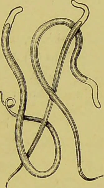 An illustration from Clinical diagnosis : the bacteriological, chemical, and microscopical evidence of disease / By Dr. Rudolf v. Jaksch, ... Translated from the third German edition and enlarged by James Cagney, ... With numerous illustrations (partly in colours)., 1893, leaf 87
